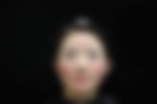 宁波熙美安茹整形医院真实口碑好评精选