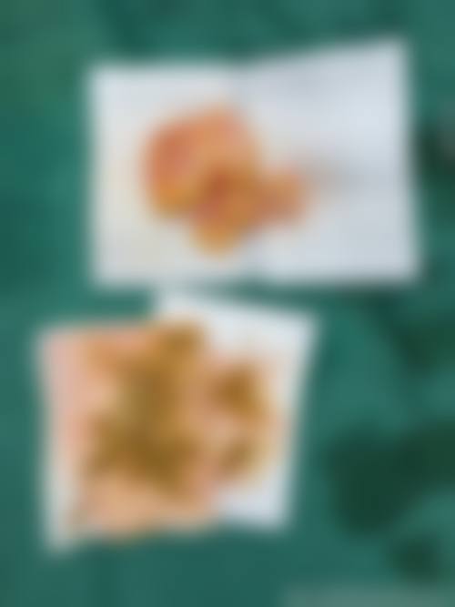 服务流程与优惠活动详情