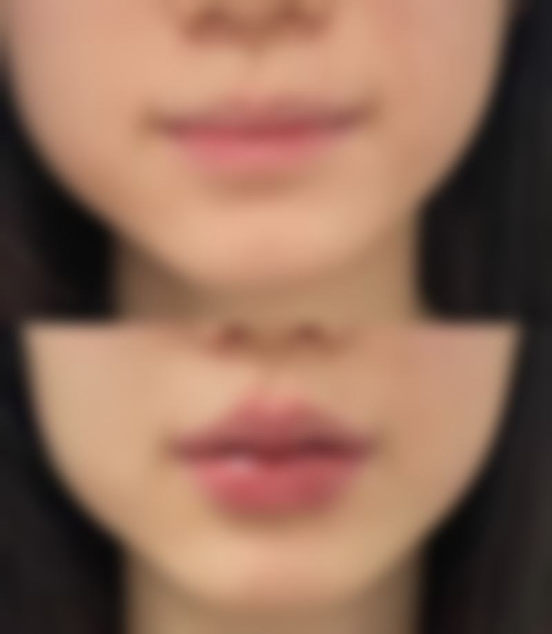 便捷预约流程与常见问题解答
