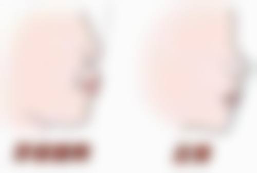 兴华美臣口腔预约挂号方式及就诊指南