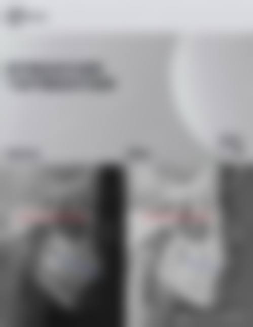 数字化设备加持,精细效率高解决口腔难题