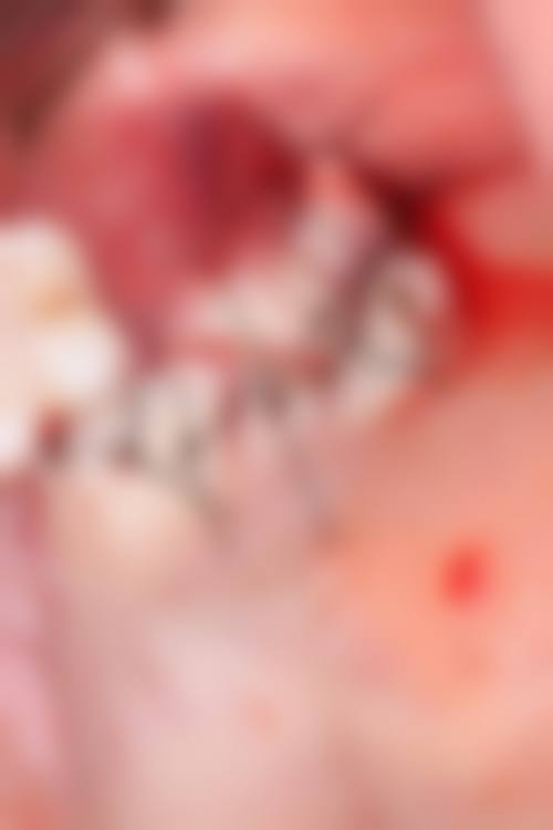 预约优惠活动