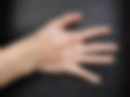 临床实例分享