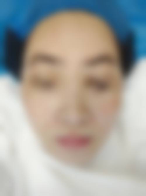 临床实例分享
