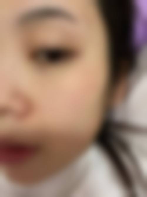 擅长项目详解:韩玉+北京海医悦美医疗美容门诊部+核心项目