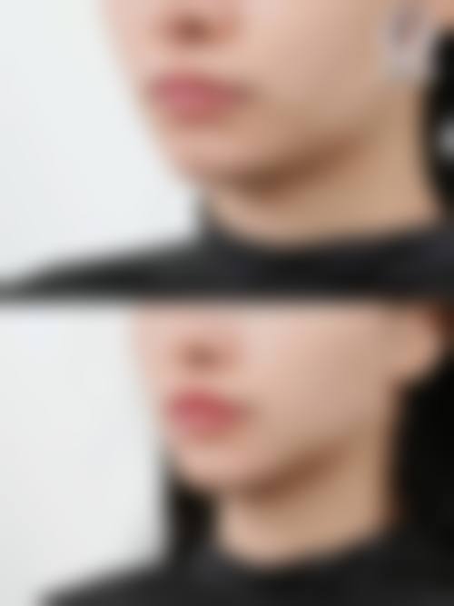 患者真实评价