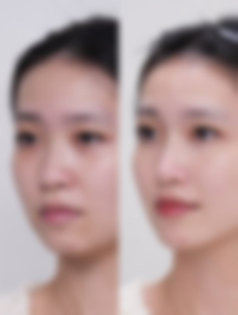 临床实例分享