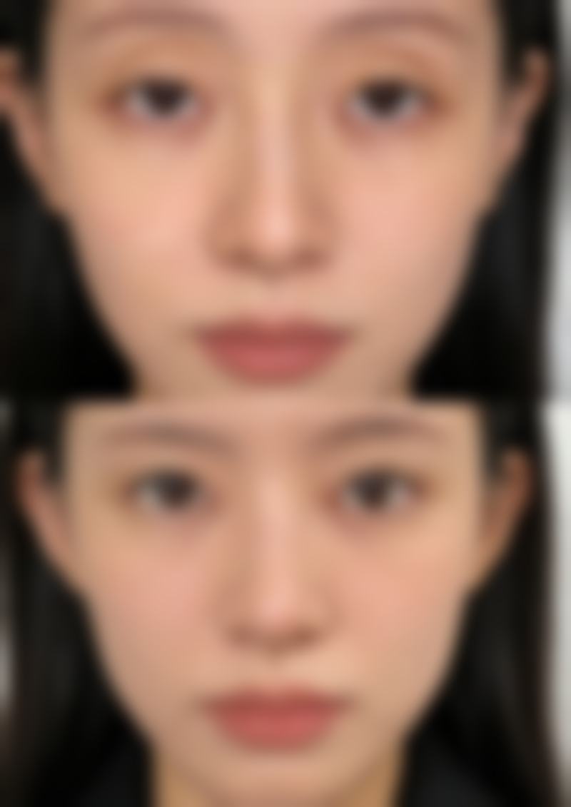 韩国Designer整形外科徐仁洙医生收费价格参考(2026年)