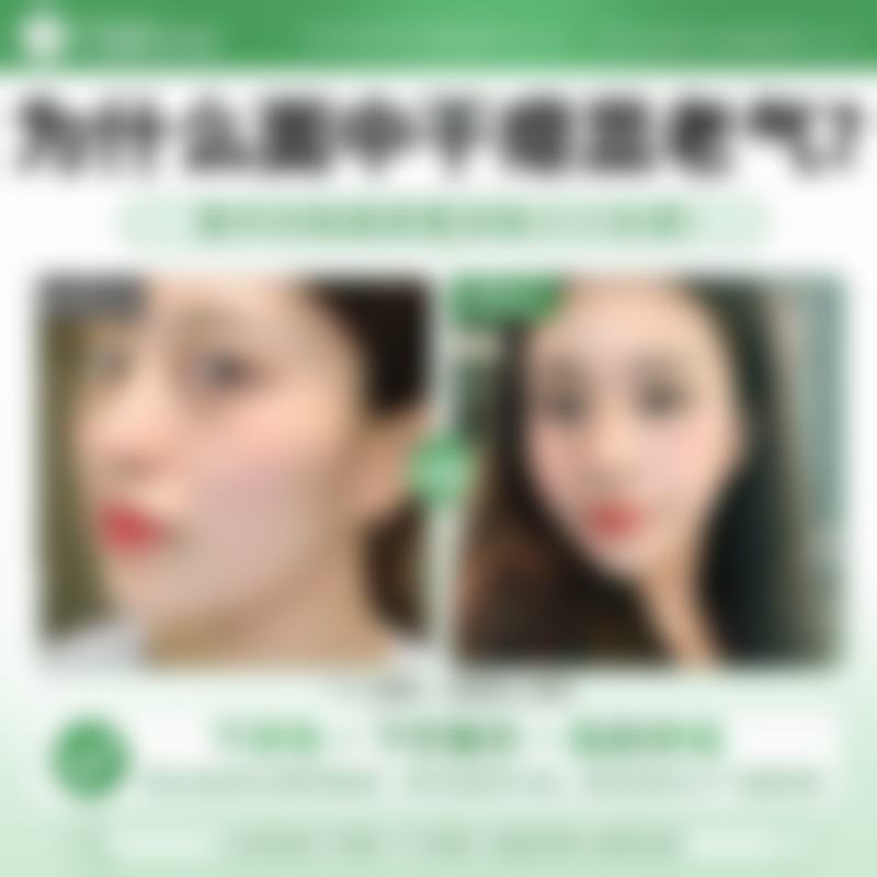 Lumenis M22 ResurFx 点阵激光:重塑肌肤年轻态的核心技术