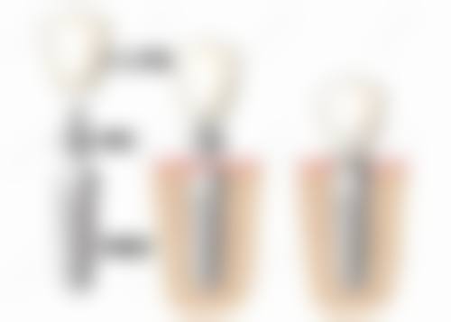临床实例分享