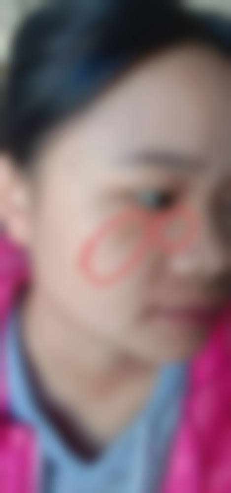 患者常见问题解答