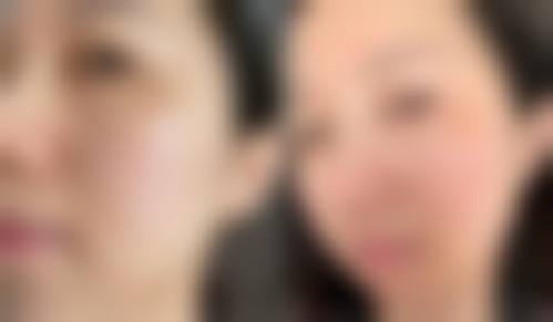 常见问题解答与预约指南