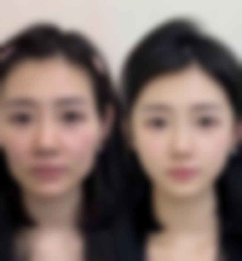 宿州天使医疗美容医院预约挂号指南