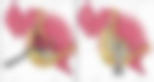 临床实例分享