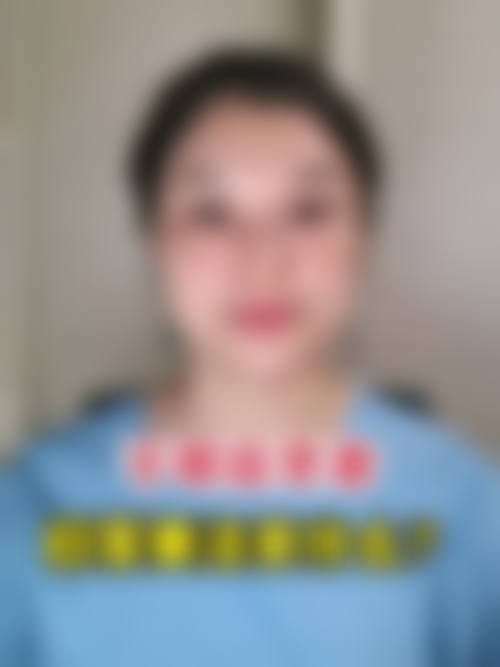 诊疗特色总结:中山五院眼科顾敏医生优势在哪?