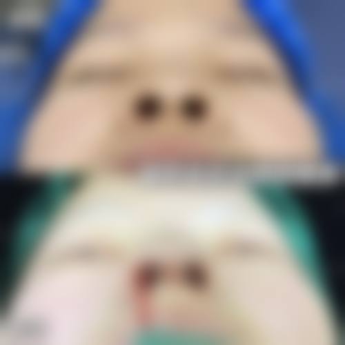 惠州元辰医疗美容预约挂号方式及问答