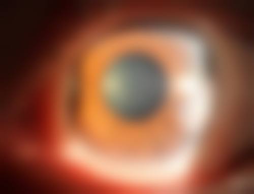 走进通辽朝聚眼科医院:硬件设施与团队实力