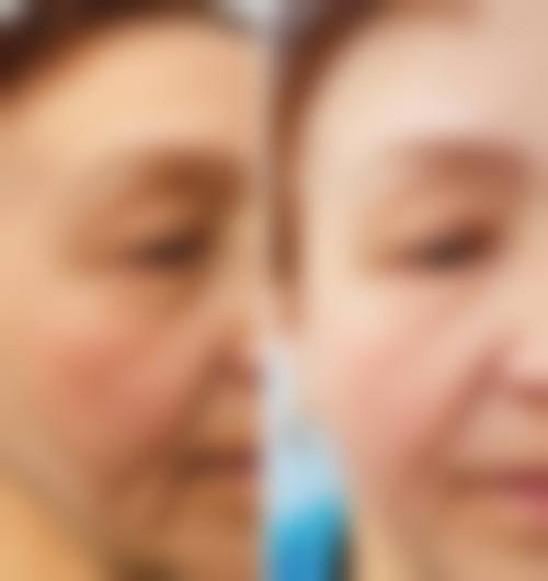 临床实例分享:真实反馈见证改变