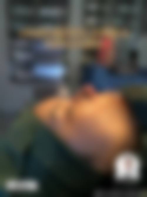 擅长项目详解:眼鼻精细化雕刻与面部年轻化