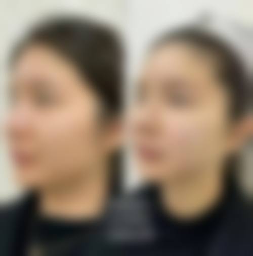总结