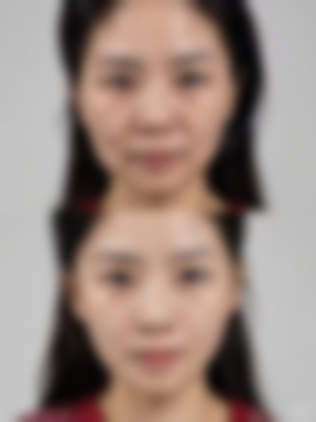 哈尔滨女王医疗美容:前列设备与擅长项目解析