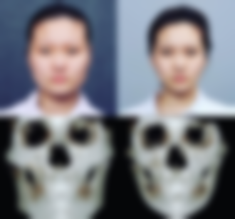 厦门思明庄榕整形医疗美容门诊部石红艳医生口碑与患者真实评价
